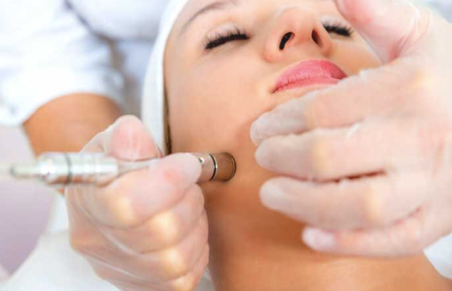 Microdermabrasion