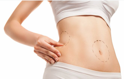 Liposuction Post-Operative Care