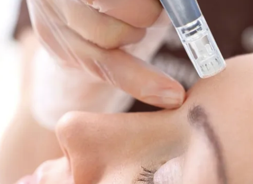 Dermapen Micro Needling (Microagujas)